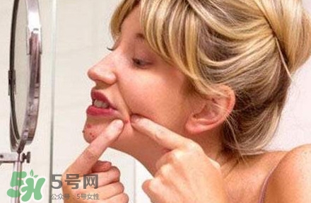 下巴長(zhǎng)痘怎么辦？下巴長(zhǎng)痘怎么調(diào)理
