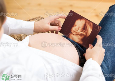 橄欖油真的可以預(yù)防妊娠紋嗎？橄欖油真的可以去妊娠紋嗎？