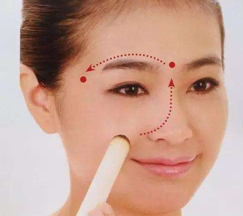 艾灸可以去黑眼圈嗎？艾灸可不可以去黑眼圈