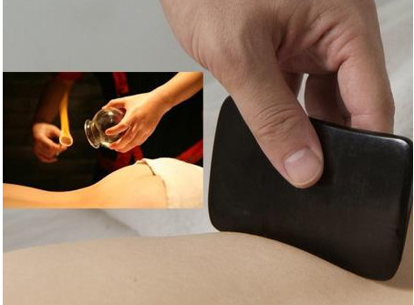 刮痧之后可以拔罐嗎？刮痧之后可不可以拔罐