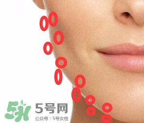 nuface美容儀有效嗎？nuface美容儀副作用？