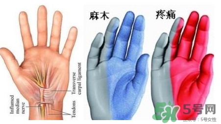 手腳發(fā)麻是缺鈣嗎？手腳發(fā)麻是不是缺鈣