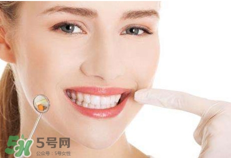牙結石是什么？牙結石圖片