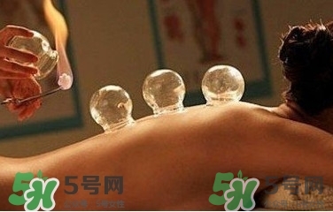 拔火罐疼嗎？拔火罐疼不疼