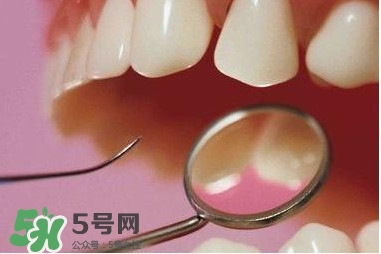 牙周炎傳染嗎？牙周炎會不會傳染