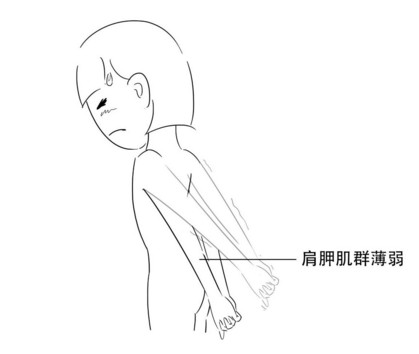 高低肩怎么糾正？高低肩的危害