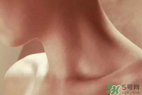頸椎老化是什么??？頸椎老化的癥狀