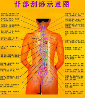 背部怎么刮痧視頻？背部刮痧手法視頻