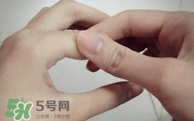 痛風(fēng)有什么癥狀？女性痛風(fēng)的初期癥狀