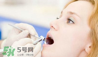 牙齒松動能自己恢復嗎？牙齒松動會自己恢復嗎