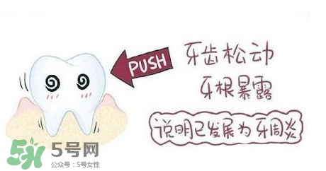 牙齒松動能自己恢復嗎？牙齒松動會自己恢復嗎