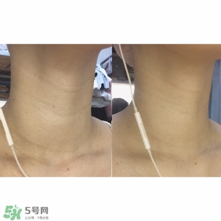 悅薇適合什么年齡？資生堂悅薇適合年齡段