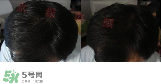  資生堂不老林洗發(fā)水怎么樣？資生堂不老林洗發(fā)水能長頭發(fā)嗎
