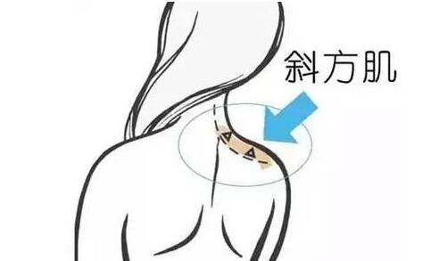天鵝頸是什么樣的？天鵝頸怎么練？