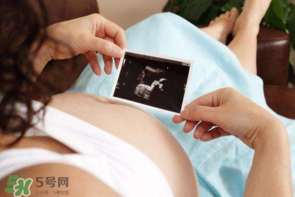 四維彩超能看出男女嗎？四維彩超能看清手指嗎？