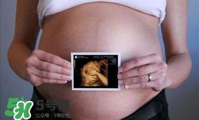 四維彩超能看出男女嗎？四維彩超能看清手指嗎？