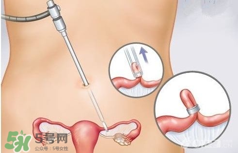 女人怎樣避孕最安全？對(duì)女人最好的避孕方法