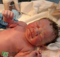新生兒手握避孕環(huán)出生是怎么回事？出生后健康嗎？