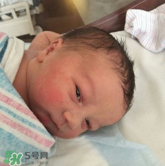 新生兒手握避孕環(huán)出生是怎么回事？出生后健康嗎？