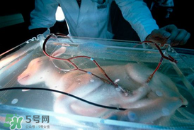 人造子宮能生孩子嗎？人造子宮成功案例