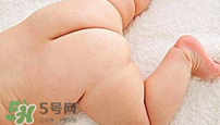 尿布疹怎么辦？寶寶尿布疹擦什么藥好？