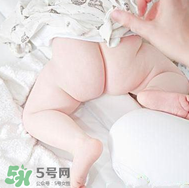 尿布疹和濕疹的區(qū)別 尿布疹和濕疹如何區(qū)分？