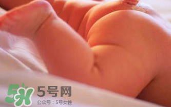 寶寶尿布疹可以擦紅霉素軟膏嗎？紅霉素軟膏對尿布疹有效嗎？
