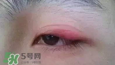 長期用假睫毛雙眼皮貼對眼睛有什么傷害？