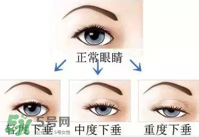 長期用假睫毛雙眼皮貼對眼睛有什么傷害？