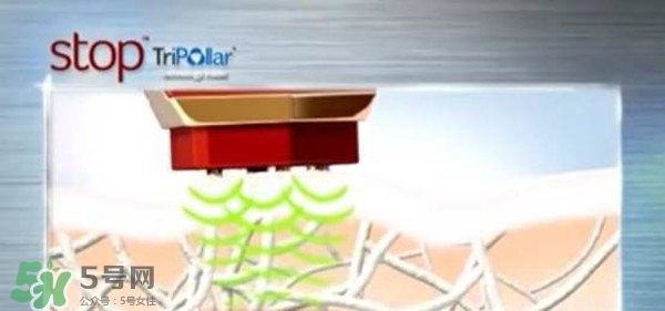 tripollar stop怎么樣？tripollar pose好用嗎