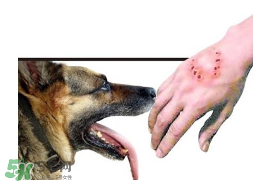 狂犬病會(huì)傳染嗎？狂犬病會(huì)學(xué)狗叫嗎
