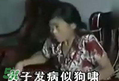 狂犬病能治好嗎？狂犬病的早期癥狀