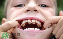 兒童換牙可以吃鈣片嗎?兒童換牙吃什么好？