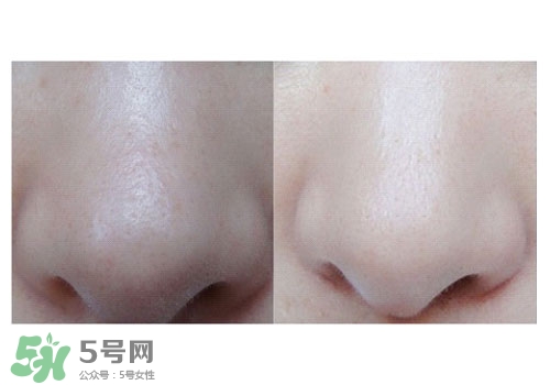 碧柔鼻貼白色和黑色哪個(gè)好？碧柔鼻貼黑白區(qū)別
