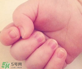 寶寶指甲凹凸不平是什么原因？寶寶指甲凹凸不平正常嗎？