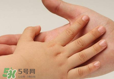 寶寶指甲凹凸不平是什么原因？寶寶指甲凹凸不平正常嗎？