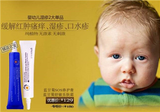 恩姆花園濕疹膏有激素嗎？恩姆花園濕疹膏含不含激素？