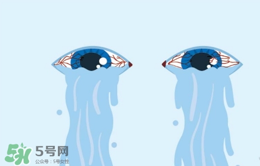 眼藥水可以兩個(gè)人用嗎？眼藥水可以共用嗎？