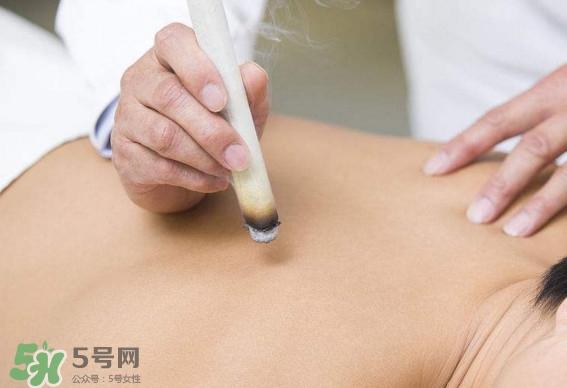 一天中什么時間艾灸好？艾灸什么時間做最好