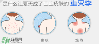 妙思樂爽膚水好用嗎？妙思樂爽膚水能去痱嗎？