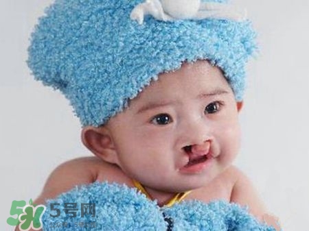 兔唇可以治嗎？兔唇修補術(shù)