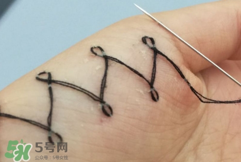 人體刺繡是自殘嗎？人體刺繡有什么危害