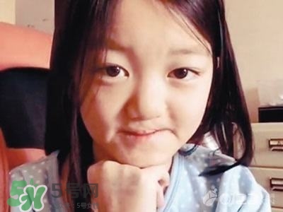 兔唇是什么？兔唇是什么原因造成的？