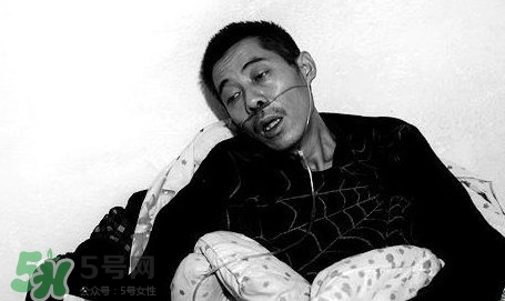 塵肺病吃什么藥能清肺？塵肺病國家有什么政策