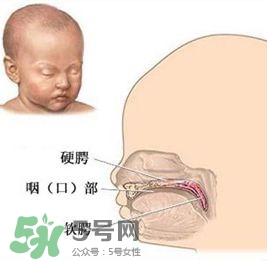 兔唇能檢查出來(lái)嗎？兔唇能完全修復(fù)嗎？