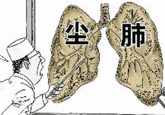 塵肺病能治愈嗎？塵肺病能活多久