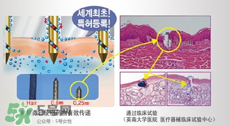 珠兒麗蚊子針好用嗎？珠兒麗蚊子針副作用