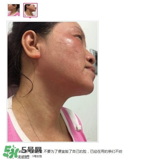 肌膚之食是什么牌子？肌膚之食讓我毀容了