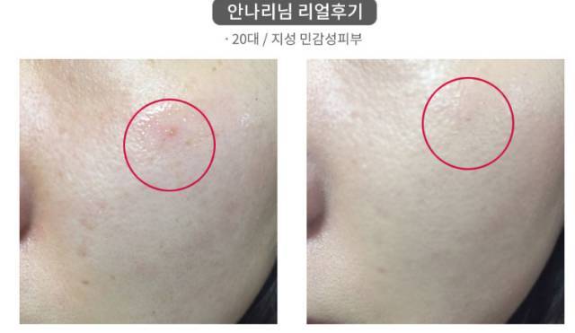 real skin patch怎么樣？real skin是什么牌子