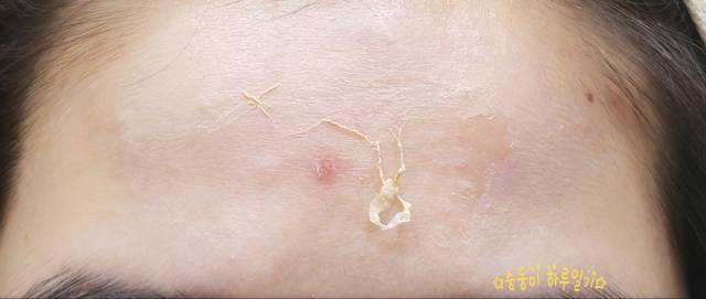 real skin patch怎么樣？real skin是什么牌子